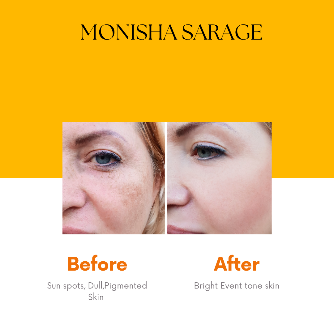 Monisha Sarage Radiating Face Wash| Niacinamide and Vitamin C| Advanced Formulation |Helps with Dark Spots| Suitable for All Skin Types | 100mL